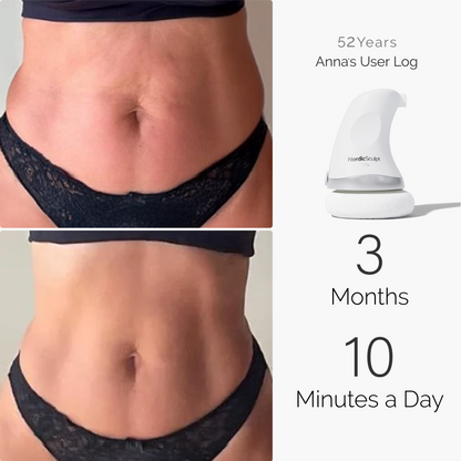 BodySculpt 1.0™