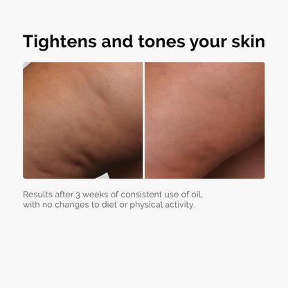 BodyOil Toning & Tightening™